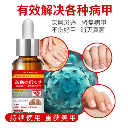 Higashida Japan's No. 1 genuine onychomycosis effective drug for fungal infection, thickening onychomycosis, antibacterial, 1 box, suitable for onychomycosis