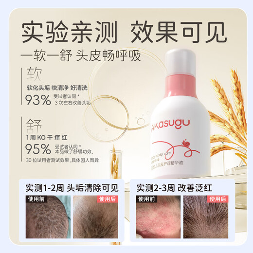 Akasugu爱舒屋婴幼儿去头垢精华液50ml宝宝护发软化头垢奶痂温和头皮护理