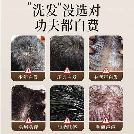 HIEUAILR Heshou Black Ganoderma Lucidum Shampoo Natural Black Hair Blossom and White Hair Turning Black to Treat Hair Roots and Prevent Loss