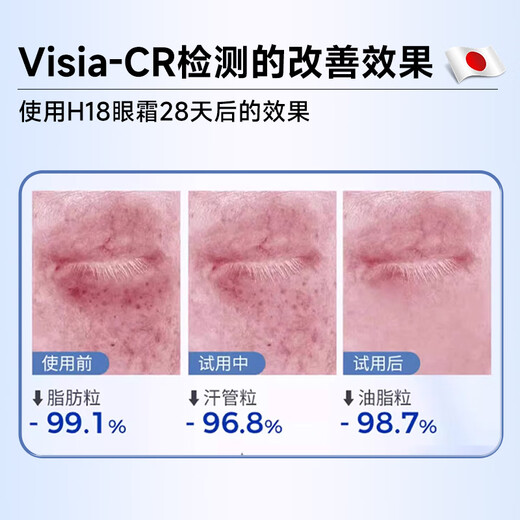 H18日本颗粒清肌眼霜脂肪粒去除眼部专用非药膏汗管去除药膏男女专用