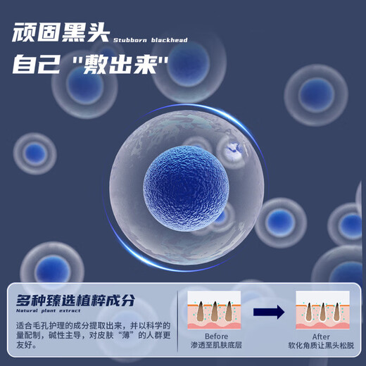 MKAK男士水乳洗面奶套装控油清爽补锁水细致毛孔改善油腻护肤礼物520 MKAK鼻头贴2盒