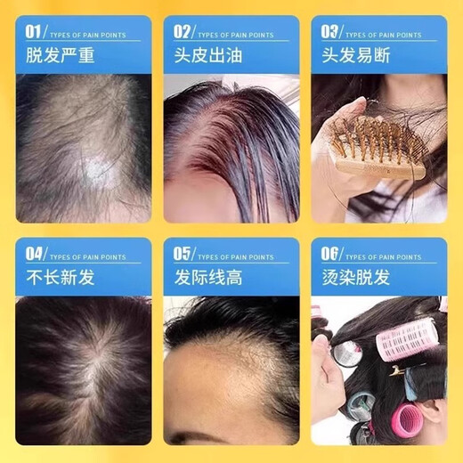 南京同仁堂防脱育发洗发水生姜洗发露头发增长密固发增长脂溢性脱发严重男女 一瓶装400ml【医师认证】