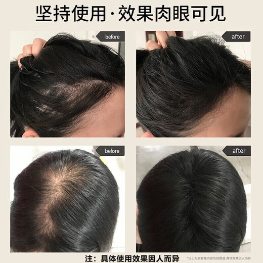 
Tongrentang Anti-Hair Depth Shampoo Ginger Hair Increase Anti-Hair Loss and Control Oils Fluffy Ginger Juice Solid Hair 508g*2 Bottles