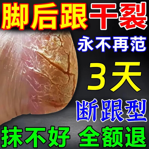 Cracked Foot Cream Heels Cracked Cracked Heels Fungal Infection Cracked Hands and Feet Peeling Cream Cracked Feet Dry Mouth Authentic 300g 3 Bottles Buy 2 Get 1 Free 1 Moisturizing Cream