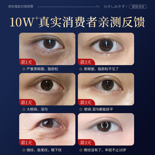 BEAUTY NOTES snake venom eye cream dilutes fine lines lift tighten dark circles 50-year-old mother removes eye bags severe eye bags men and women