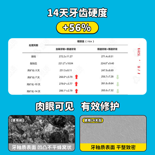 COMBO [anti-frying upgrade] Little octopus children's toothbrush containing fluorine-resistant soft hair baby baby's baby's baby's baby's baby's baby's baby's training for 0-2-6 years old