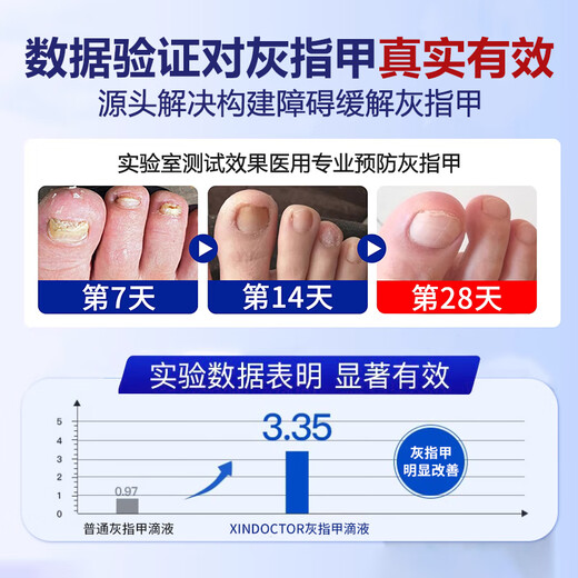 Dr. Xin's onychomycosis special effect specializes in treating nail infection with yellowing and thickening root cream 30ml.