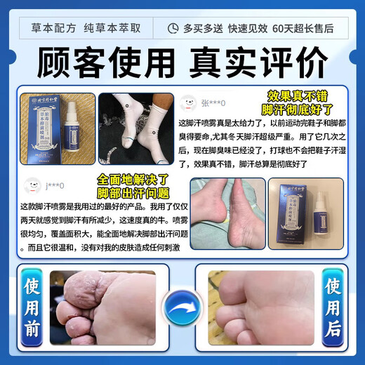 Beijing Tongrentang foot sweat and odor special anti-perspirant soak for athlete's foot and foot odor, special for excessive sweating, sore feet, athlete's foot, antiperspirant fungal infection spray, buy 2 get 1 free, 99% choice antiperspirant artifact