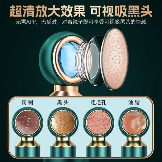 KONKA blackhead suction visual facial beauty export instrument household facial acne pore cleaning artifact 1499 tail goods machine quality home appliances visual non-blind suction 2-speed intensity adjustment 3 plastic suction heads rear magnifying glass display
