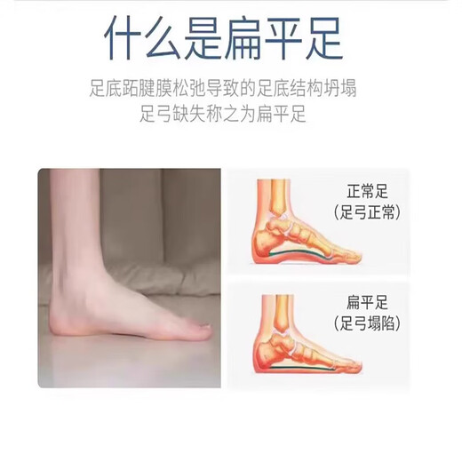 回力君扁平足专用洞洞鞋男款缓解足跟痛支撑足弓塌陷凉拖鞋夏款 723-黑红 42