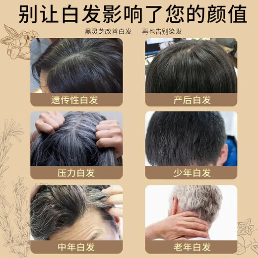 同仁堂何首乌洗发水金榜第1名五黑植萃黑灵芝白头发转养黑发洗发膏露