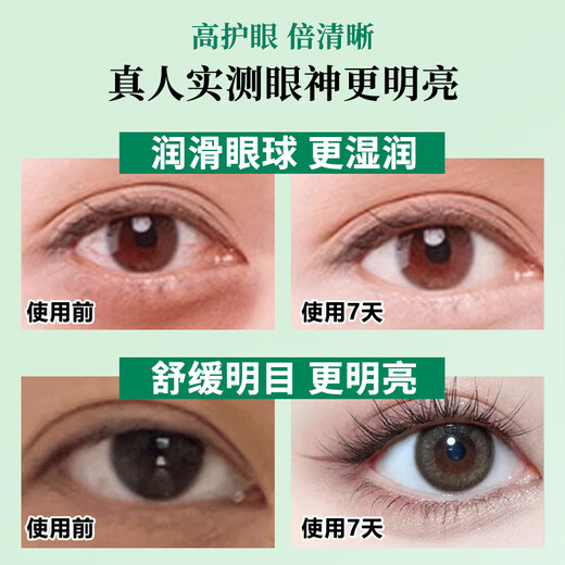 
FIT MOMENT Lutein Eye Protection Spray Cleansing Eye Relieves Dry Eye Care Eye Care Eye Cleansing Eye Cleansing Eye Moisturizing Spray