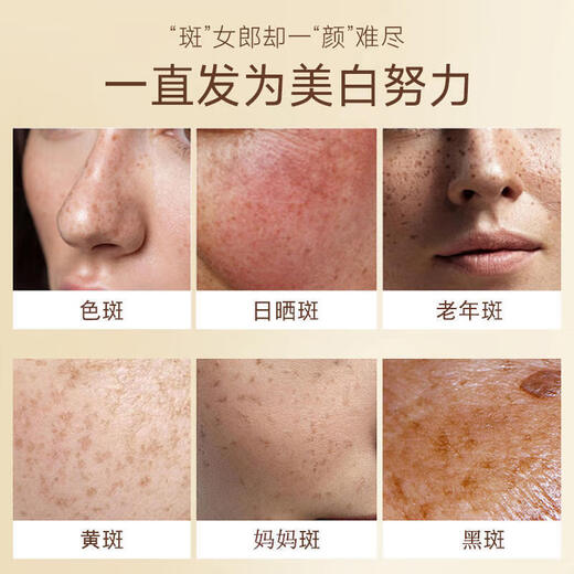 佰束佰束美白祛斑霜正品美白祛斑霜烟酰胺淡化黑色素老年斑色斑晒斑zl 【买一送一】到手2瓶 解决各种斑