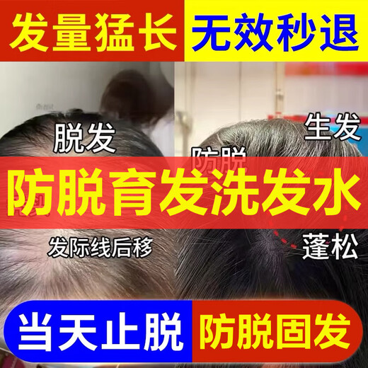 南京同仁堂防脱育发洗发水生姜洗发露头发增长密固发增长脂溢性脱发严重男女 一瓶装400ml【医师认证】