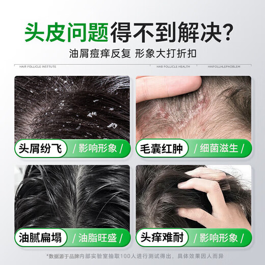 匠心丝华 JXSH胖东来二硫化硒洗发水洗剂1%毛囊清洁洗发水炎去屑止痒控油洗发露 【一瓶400ml】深度去屑止痒
