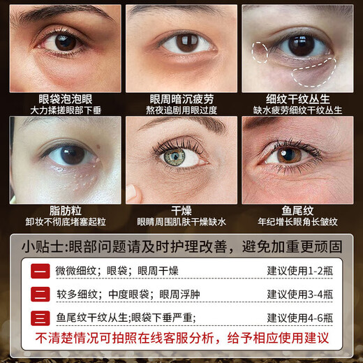 Nanjing Tongrentang Reflejando la botella de la crema de ojos de ojos claros mejora la piel seca en los ojos líneas finas círculos oscuros disponibles durante 30 años y más de 40 años 1 botella [se especializa en grandes bolsas de ojos]
