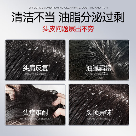 
kuvive Singapore imported oil control fluffy shampoo for men and women to remove dandruff, itch and lasting fragrance selenium disulfide shampoo 98% of customers choose 丨Two bottles 500ml*2