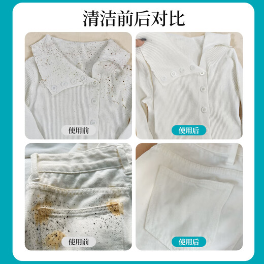 Yilianjie Mildew Remover Clothes Mildew Spot Remover 300ml School Uniforms Remove Sweat Stains, Remove Yellowing and Whitening Black Chicken Net Cleaner