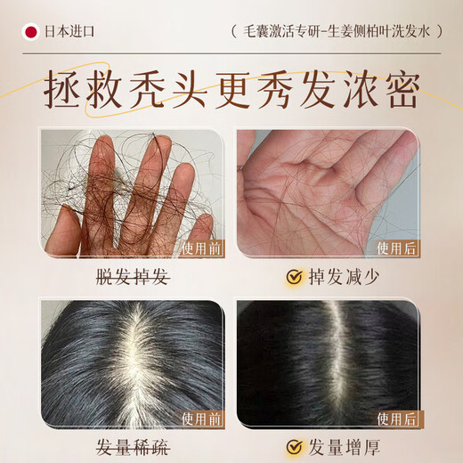 El Dr. Jiao Japón Fat Donglai Shampoo evita la degeneración y ocurre en la aparición de hojas de ciprés de orquídeas de jengibre para fortalecer el crecimiento del cabello y aumentar la densidad y la pérdida de cabello severamente para las mujeres.