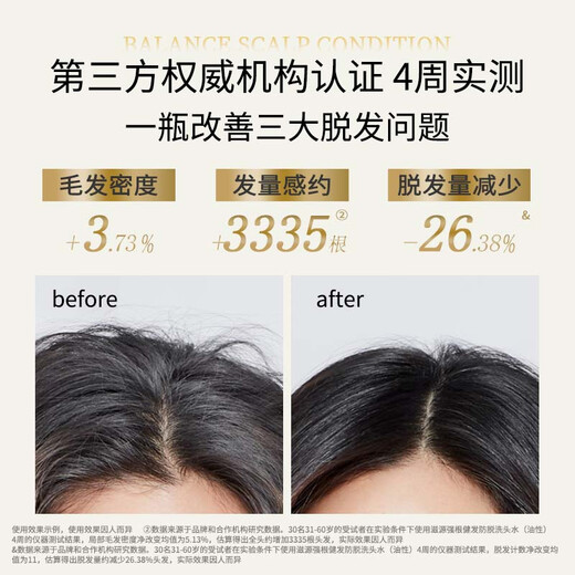 Ziyuan Ingwer verhindert Haarausfall und Haare festes Shampoo für Männer und Frauen Haarausfall Shampoo ölig 400 ml