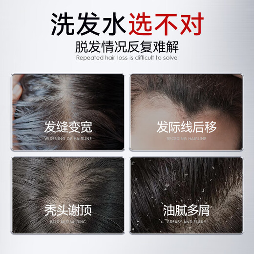 Kuvive Singapore Импорт шампунь для дегенерации против HAIR для мужчин и женщин.