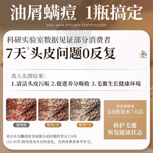 LD男女士专用进口原料毛囊去屑止痒控油持久蓬松除蟎炎清洁洗发水