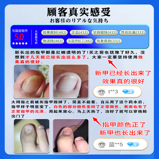 Guangyao Baiyunshan onychomycosis 100% special effect medicine No. 1 nail fungus infection removal onychomycosis root I treatment imported severe special effects in a box