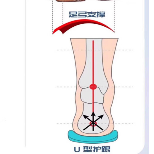 回力君扁平足专用洞洞鞋男款缓解足跟痛支撑足弓塌陷凉拖鞋夏款 723-黑红 42