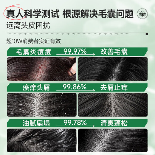 匠心丝华 JXSH胖东来二硫化硒洗发水洗剂1%毛囊清洁洗发水炎去屑止痒控油洗发露 【一瓶400ml】深度去屑止痒