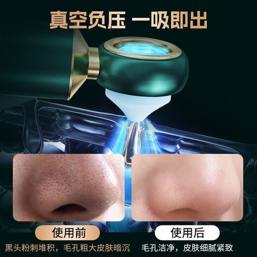 KONKA blackhead suction visual facial beauty export instrument household facial acne pore cleaning artifact 1499 tail goods machine quality home appliances visual non-blind suction 2-speed intensity adjustment 3 plastic suction heads rear magnifying glass display