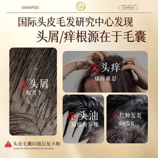 LD男女士专用进口原料毛囊去屑止痒控油持久蓬松除蟎炎清洁洗发水