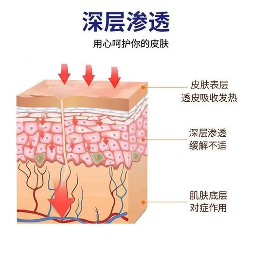 Biphenyl care cream relieves itchiness, peeling and rotten feet, blisters, sterilizes itchy feet, fungi, special effects on foot odor, toe joints, 999 times the effect* for severe pain, buy one get one free