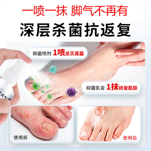 Nanjing Tongrentang athlete's foot spray to relieve itching, peeling, rotten feet, fungal infection, sweaty feet and foot odor, special wolfsbane to treat athlete's foot