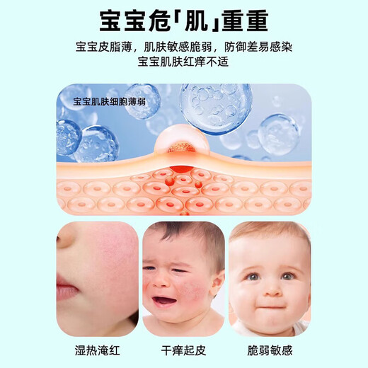 Nobif Infant Antibacterial Cream Newborn Baby Wet Itchy Newborn Rash Flooded Neck Drool Repair Baby Butt Cream