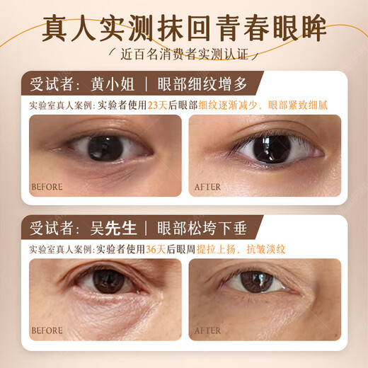 同仁堂眼霜淡化细纹提拉紧致眼周去除黑眼圈眼袋消除脂肪粒抗皱严重眼袋 买2送1【针对严重眼袋】