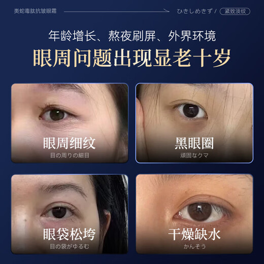 BEAUTY NOTES snake venom eye cream dilutes fine lines lift tighten dark circles 50-year-old mother removes eye bags severe eye bags men and women