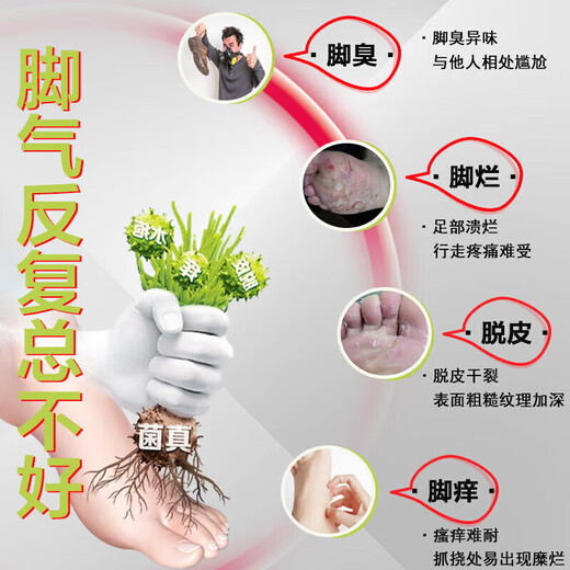 Nanjing Tongrentang athlete's foot spray to relieve itching, peeling, rotten feet, fungal infection, sweaty feet and foot odor, special wolfsbane to treat athlete's foot