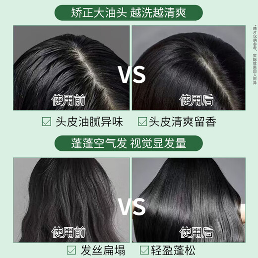 Shiseido Professional Hair Salon Care Channel Control de aceite de acción prolongada para restaurar el cabello refrescante y la cara desnuda. Atmósfera fragante Serie de cuero cabelludo champú de control de aceite 500ml