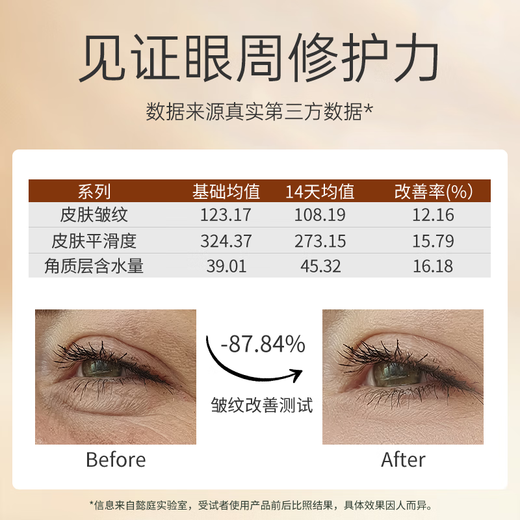 Yiting Polypeptid Eye Essence Anti-Falten-Augencreme für Frauen, die feine Linien hellen, um schwarze Kreise Augencreme zu streiten