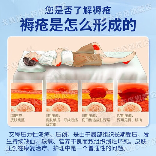 Special medicine for bedsores, bedsore ointment for external use on the buttocks of the elderly, bedsore ulcers and long-term bedridden skin ulcers medicine to promote wound healing, pressure sores, blisters, erythema, pain, muscle exposure, boric acid ointment 1 box, skin damage and ulceration, erythema and suppuration, multiple boxes recommended