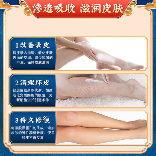 Hong Kong Pharmacy Fish Scale Skin Moisturizing Cream Snake Skin Leg Texture Special Hair Follicle Keratosis Peeling Skin Moisturizing Body Lotion Package 1 box (100g) Initial effect Fading lines