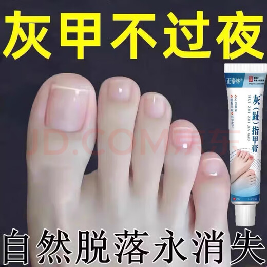 Empty, damaged, thickened and yellowed nails, herbal armor, severe onychomycosis, antiseptic liquid, brightening nail antibacterial ointment artifact 699+ Moderate