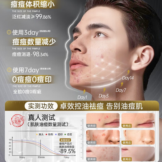 
Korean Grain Salicylic Acid Mask for Men's Oil Control and Acne Marks Removal of Acne Marks Blackhead Shrinking Pores Whitening Hydrating Moisturizing Soothing Repair
