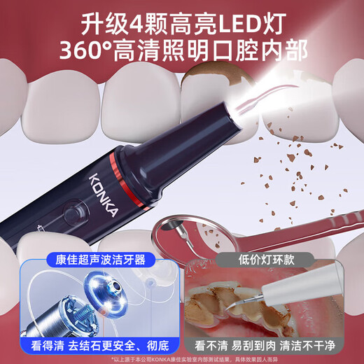 KONKA Ultrasonic Teeth Cleaner Teeth Cleaner Calculus Remover Cleans Teeth and Removes Yellow Calculus Cleaner Medical Gift Starry Sky Blue Ultrasonic Medical Device Certification Rechargeable + Full Set of Teeth Cleaning Tools