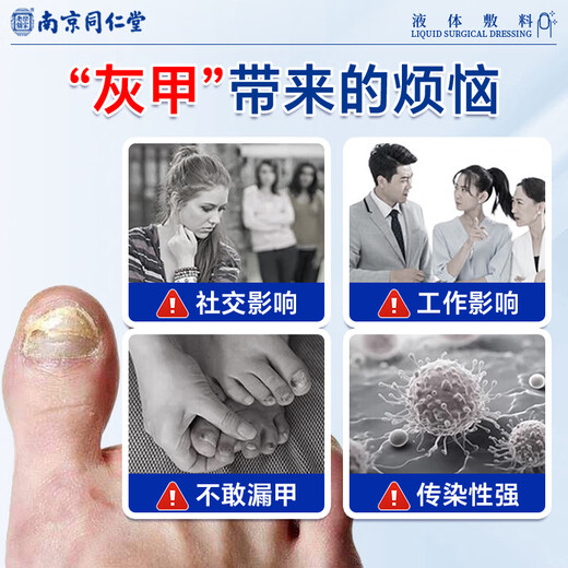 Tongrentang's 100% special medicine for treating severe onychomycosis, impatiens antibacterial liquid, fungal infection, 3 boxes of special onychomycosis liquid (severe can be cured)