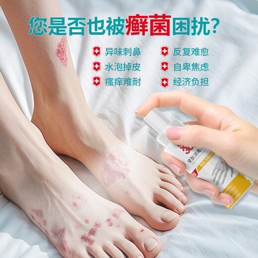 
99309930 Skin Disinfection Spray Spray Ash Disinfection Fungus Bacteria Itchy Pain Skin Infection 50ml/bottle 9930 Skin Disinfection Spray 50ml