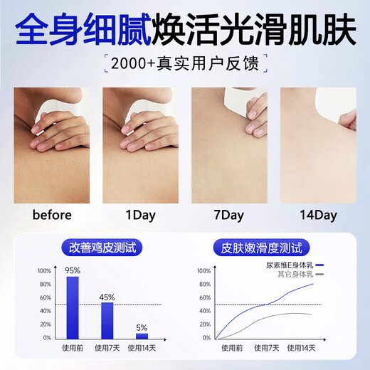 SEEDONVEUR 20% Urea Cream Body Lotion Moisturizing Anti-dry Cracked Black Goose Pimple Moisturizer for Men and Women 500g