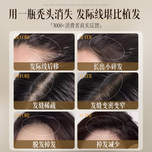Ruyi Anti-Loss Shampoo Ginger Orchidopsis Leaf Hair Reinforcement Hair Restraining Hair Hair Removal of Oil Shampoo Relieving Itchy Fluffy Shampoo Detoxification