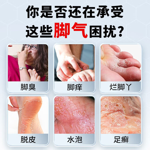 Nanjing Tongrentang athlete's foot spray to relieve itching, peeling, rotten feet, fungal infection, sweaty feet and foot odor, special wolfsbane to treat athlete's foot