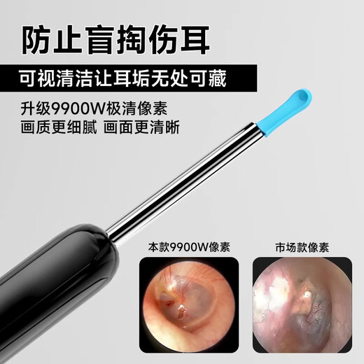 Shantou Lincun 2025 New Visible Ear Pickup Scoop Cleaning Endoscope Intelligent Luminous Ear Picking Stick Ear Picking Tool Huawei Black 300 Million Clear Pixels Fast Charging Compatible with Apple Android